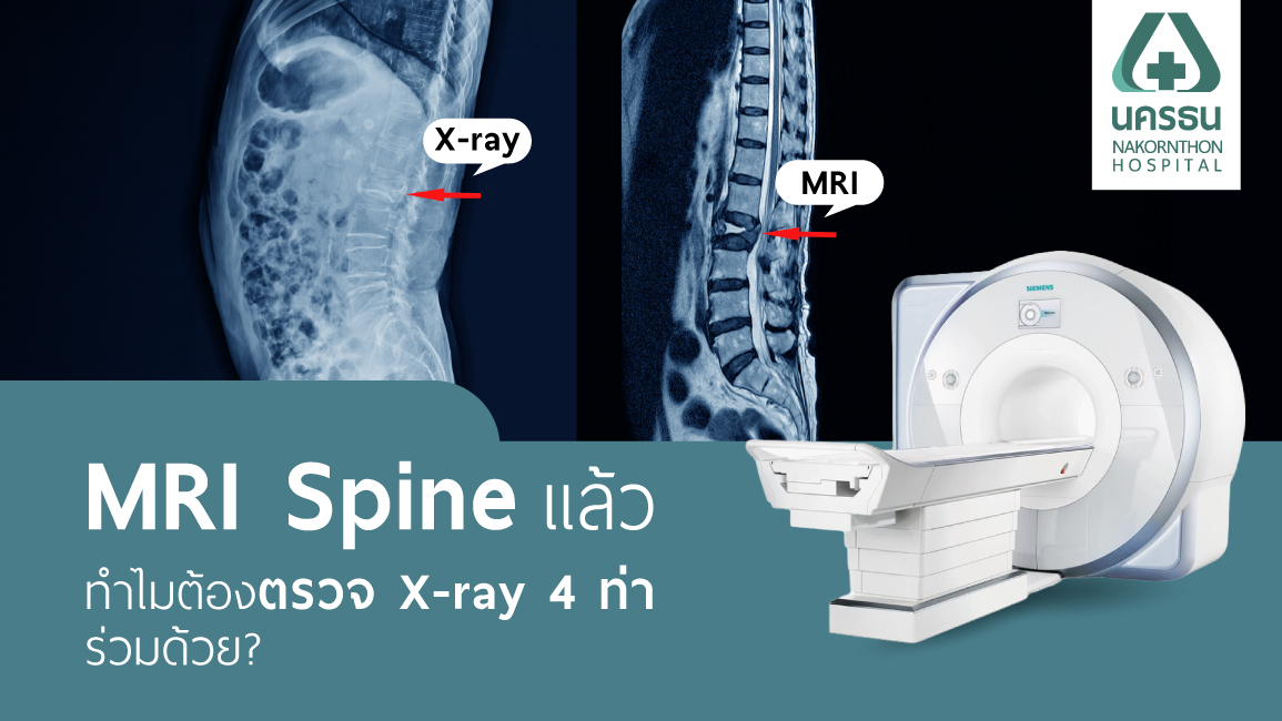 MRI Spine